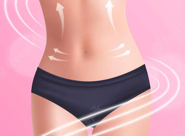 Abdominoplastia